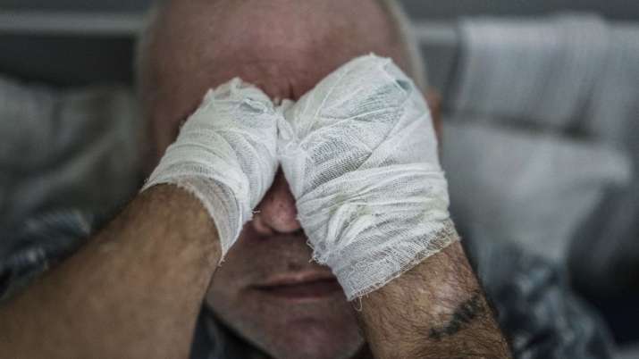 India Tv - Stanislav, an injured Russian prisoner of war, lies in bed at the detention center in Ukraine’s Lviv