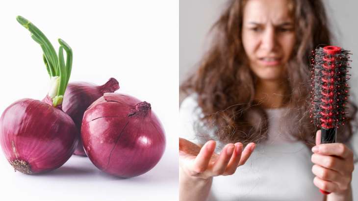 Tired of hair fall? Know these 3 onion masks to promote hair growth |  Beauty News – India TV