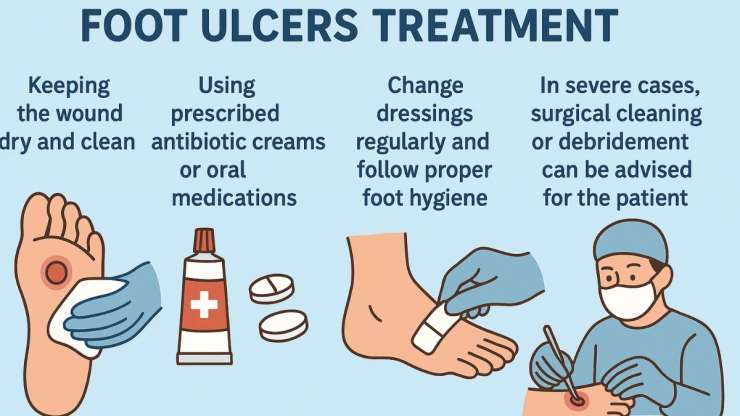 Foot ulcers treatment - India Tv