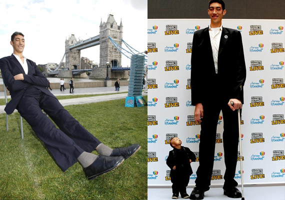 World's tallest man, 29, finally stops growing with help from Va. doctors -  CBS News