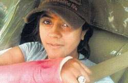 ekta injured after fall in a mumbai pothole