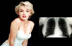 marilyn monroe x rays snapped up for 45 000