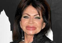 surgery has left me look like chipmunk jackie stallone