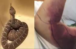 selfie with rattlesnake costs man over 150 000