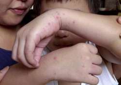 over 10 000 hit by hand foot mouth disease in vietnam