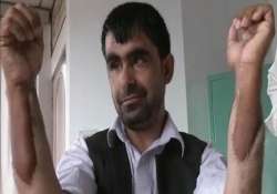 afghan military captain gets indian hands in transplant