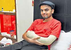 unbelievable 21 yr old man walks into delhi hospital with severed arm