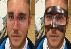 stuart broad may wear face mask for final test