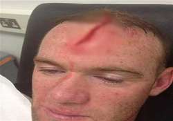 rooney posts picture of head injury