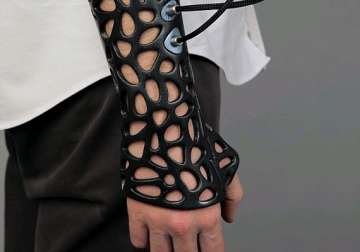 3d printed plaster cast that reduces healing time by 40 percent