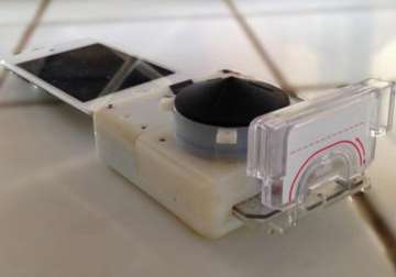 low cost smartphone accessory to diagnose hiv in 15 minutes