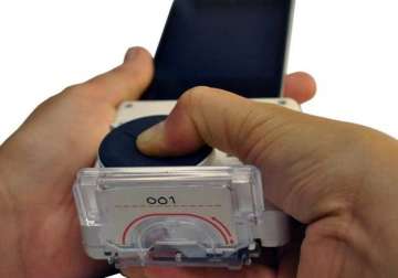 this smartphone dongle can diagnose hiv in just 15 minutes