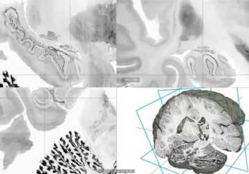 scientist develop digital 3d atlas of the brain