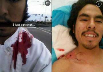 this arizona guy was shot instead of calling 911 he decided to post a seflie first