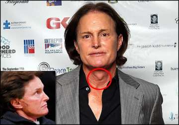 bruce jenner wants to get rid of his adam s apple