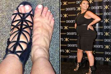 kim kardashian s swollen feet