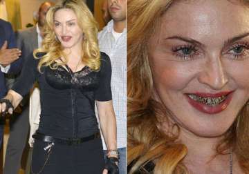 omg madonna looks horrifying in those gold grills