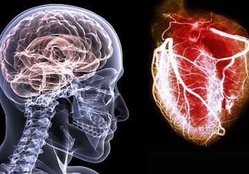 brain attacks as serious as heart attacks expert