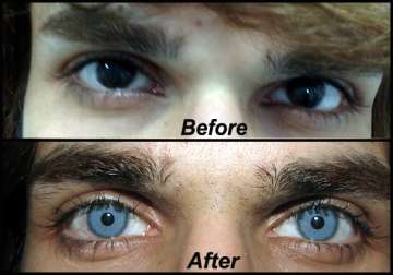 forget coloured lenses now get blue or green eyes view pics