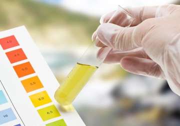 urine test may detect early stage pancreatic cancer