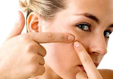 tips to avoid acne rashes in summer