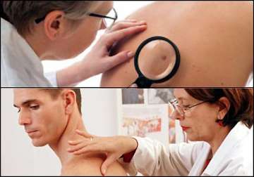 skin cancer more dangerous for men know why