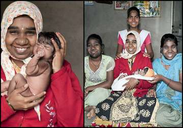 indian family cursed with werewolf syndrome see pics