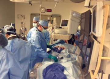 california doctors perform world s first angiovac procedure vacuum two feet long blood clot out of man s heart