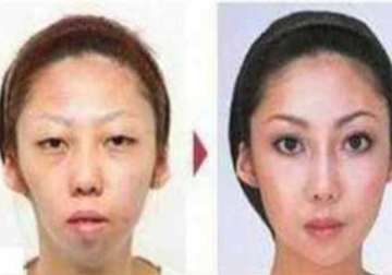 chinese man sues wife for hiding her ugliness through plastic surgeries wins lawsuit