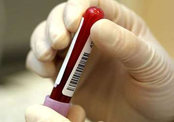 hiv cure raises hopes tempered with caution