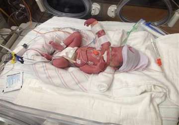 us woman dies after giving birth to quadruplets