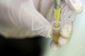 nigeria to get japanese drug for ebola treatment