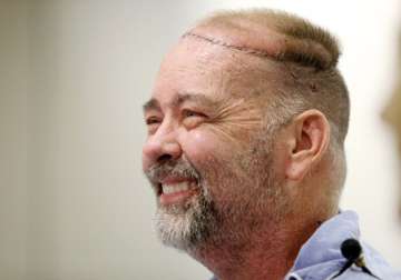 first skull scalp transplant performed by us doctors