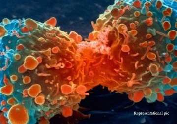 two thirds of cancer cases due to bad luck study
