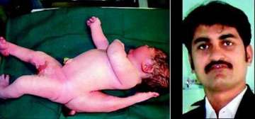 junagadh docs remove extra limb from one month old baby