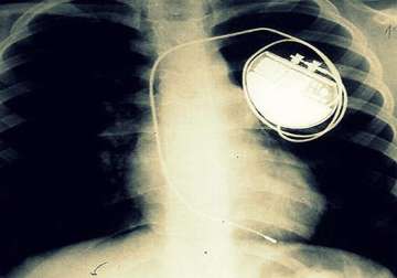 indian origin scientist makes leadless pacemaker
