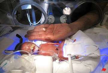 indian doc in us oversees birth of world s smallest baby into a healthy one