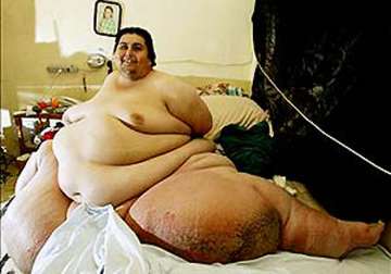 know more about the world s fattest man jon brower minnoch