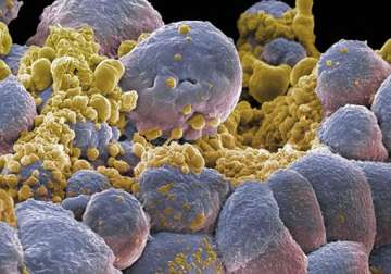 new method starves cancer cells to death
