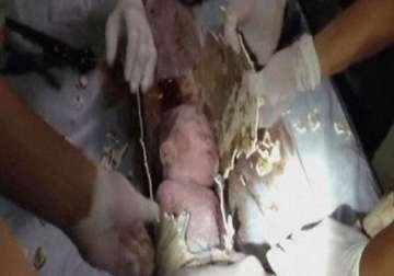 newborn baby thrown in toilet pipe in china