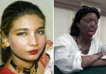pakistani dancing girl leaps to death in rome after her face was disfigured in acid attack