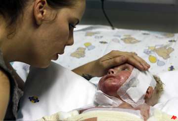 south africa cloned skin recipient to leave hospital