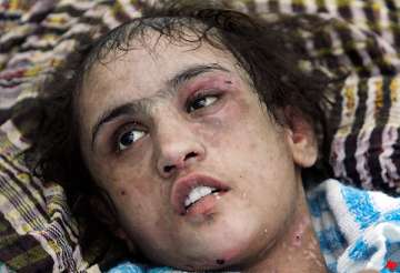 tortured afghan girl wants in laws jailed