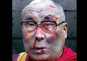 was the dalai lama subjected to physical torture by china