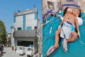 amazing conjoined twins in haryana have a single body with two heads one cries another sleeps