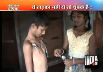 andhra boy has magnetic body attracts metal objects