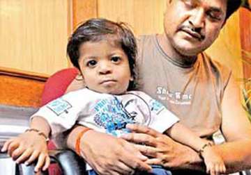 bareilly boy with 34 fingers and toes sets new record