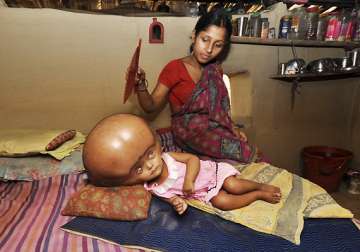 docs says tripura infant not up to intervention at present