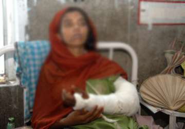 doctor to pay rs 2.75l to woman for loss of her forearm