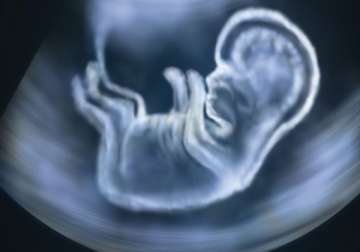 hc refuses to quash case against doctor for telling foetus gender